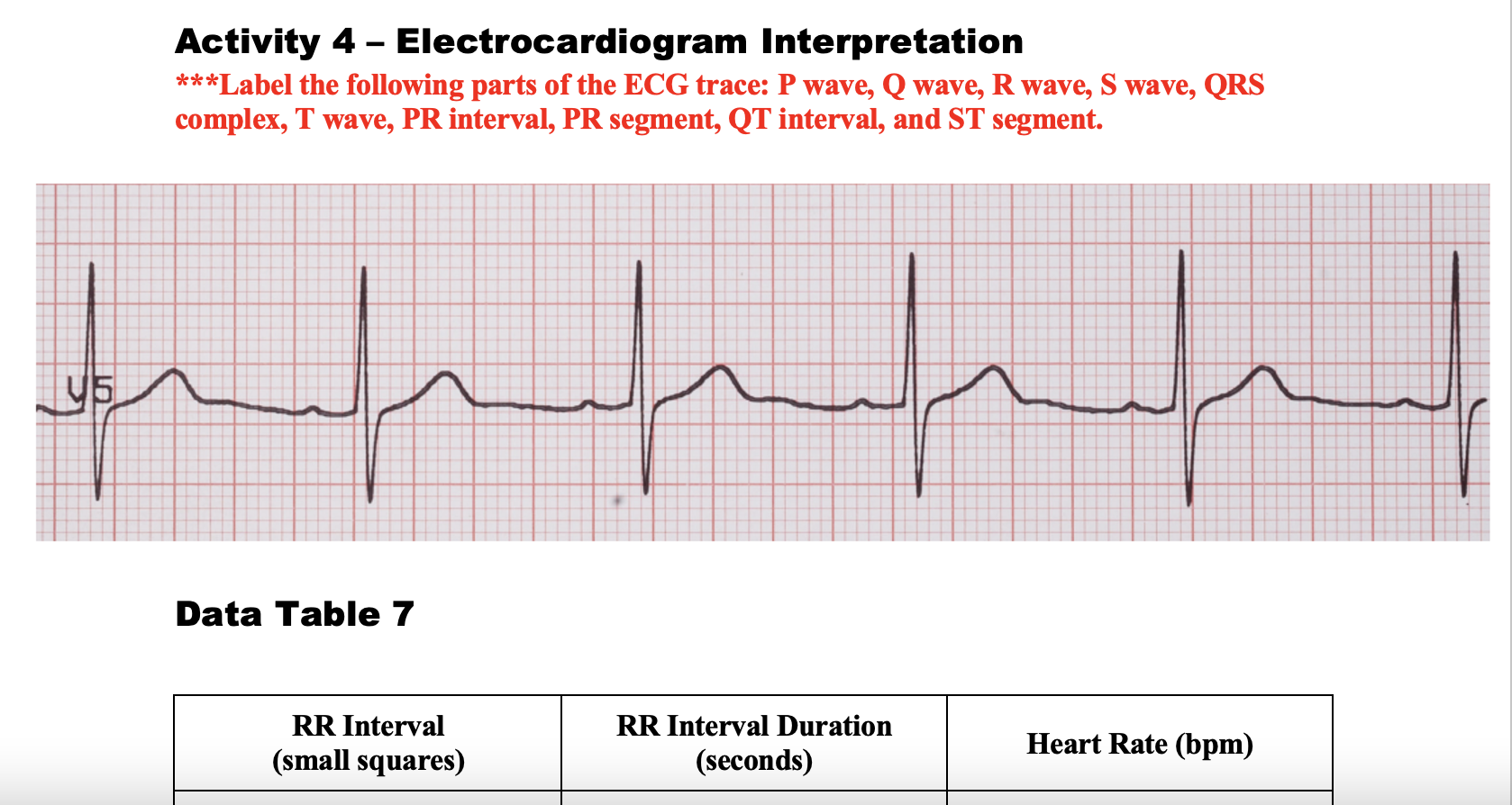 Solved Label The Following Parts Of The Ecg Trace: P Wave, Q 