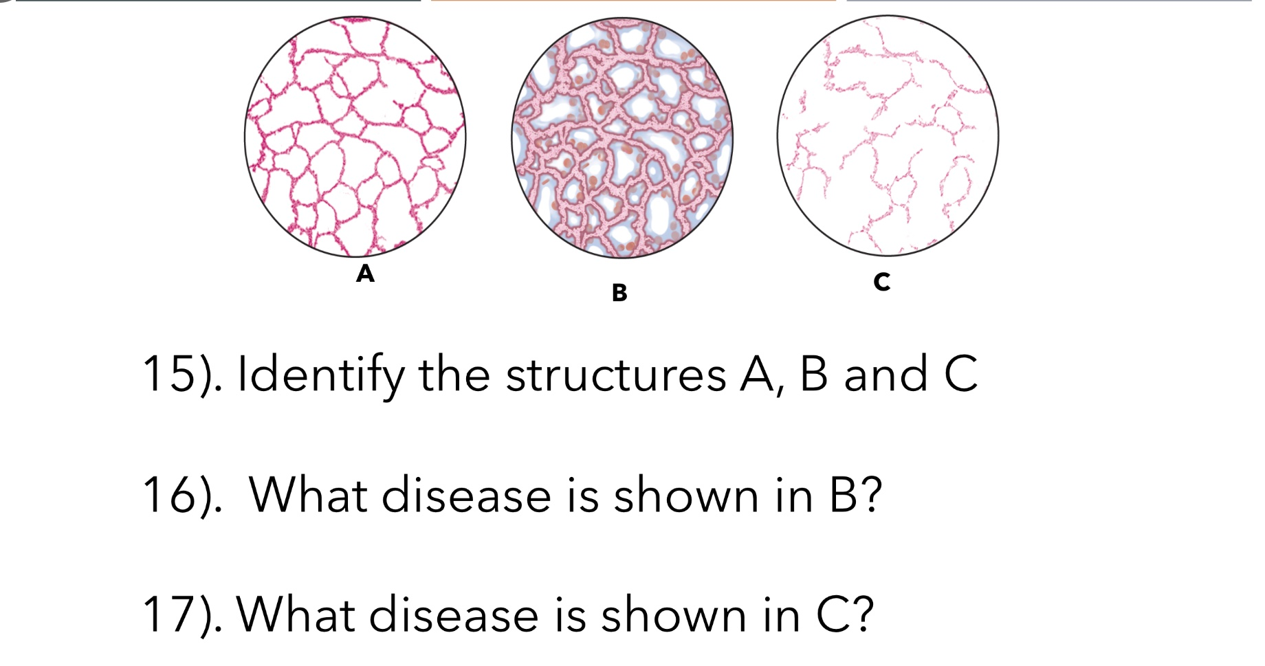 Solved A C B 15). Identify the structures A, B and C 16). | Chegg.com