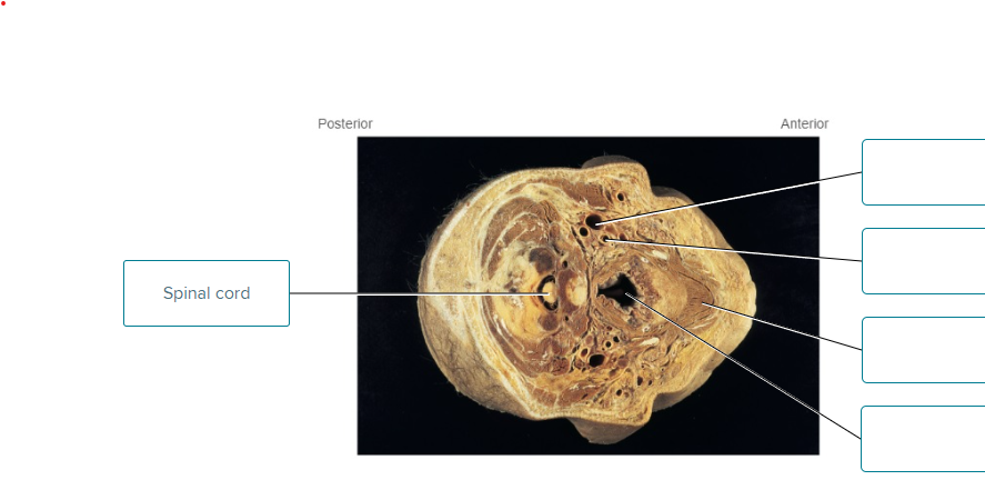 Solved label the major body parts shown in the transverse | Chegg.com