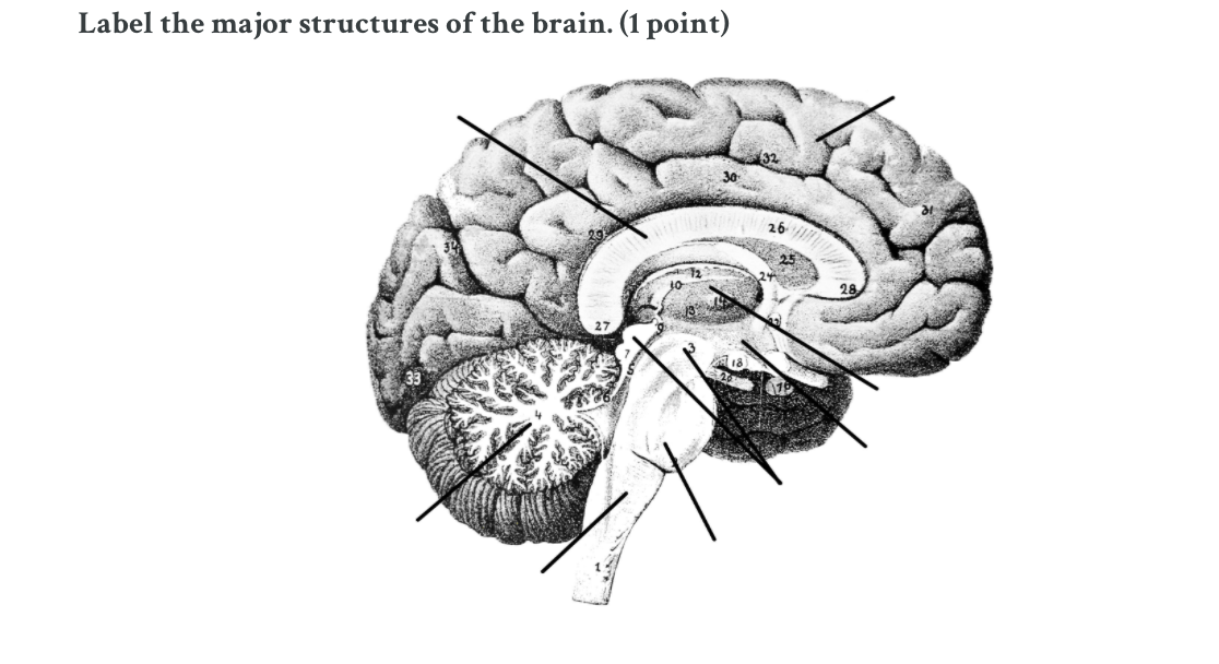 solved-label-the-major-structures-of-the-brain-1-point-chegg