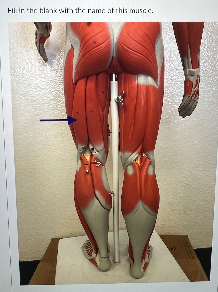 Solved Fill in the blank with the name of this muscle. | Chegg.com