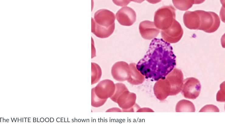 Solved The WHITE BLOOD CELL shown in this image is a/an | Chegg.com