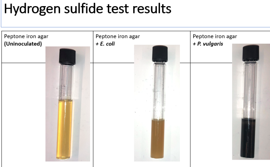 Solved Gelatin test. Fill in the chart. Organism 1 Organism