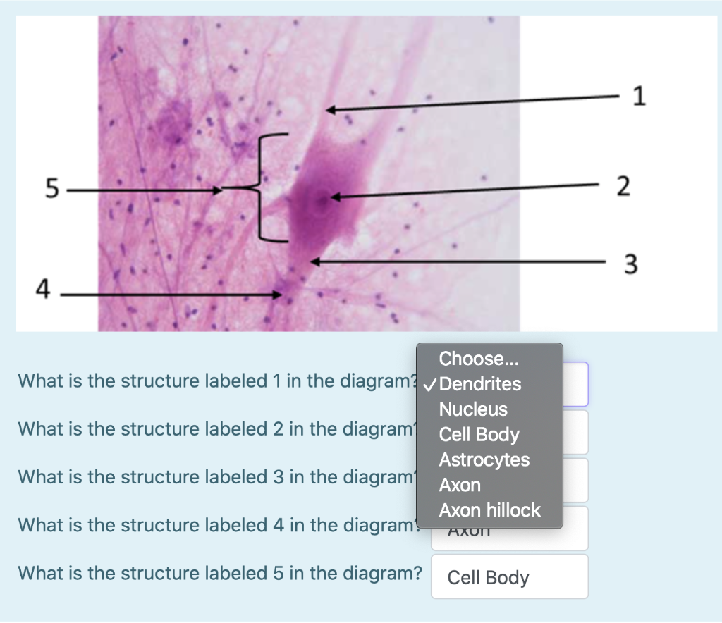 Solved 1 5 5 2 3 4 Choose... What is the structure labeled 1 | Chegg.com