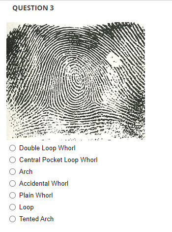 plain whorl fingerprint