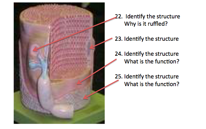 Solved 22. Identify the structure Why is it ruffled? 23. | Chegg.com