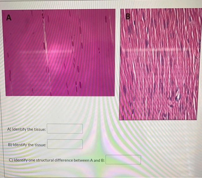 Solved А A) Identify The Tissue: B) Identify The Tissue: C) | Chegg.com