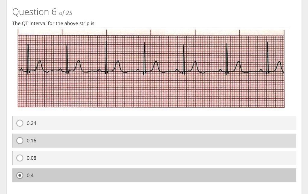 The QT Interval for the above strip is:
\( 0.24 \)
\( 0.16 \)
\( 0.08 \)
\( 0.4 \)