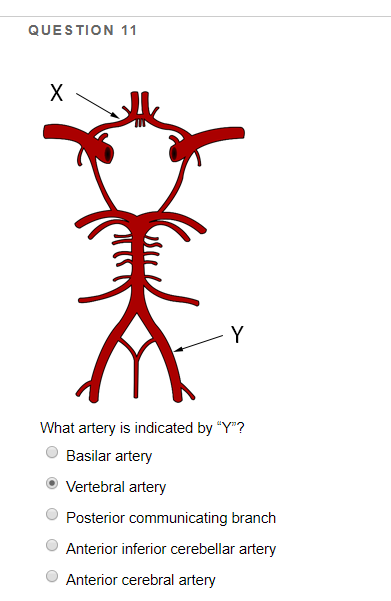 vertebral artery branches