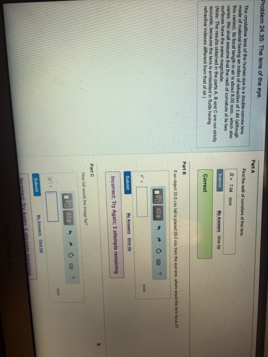 Solved The crystalline lens of the human eye is a