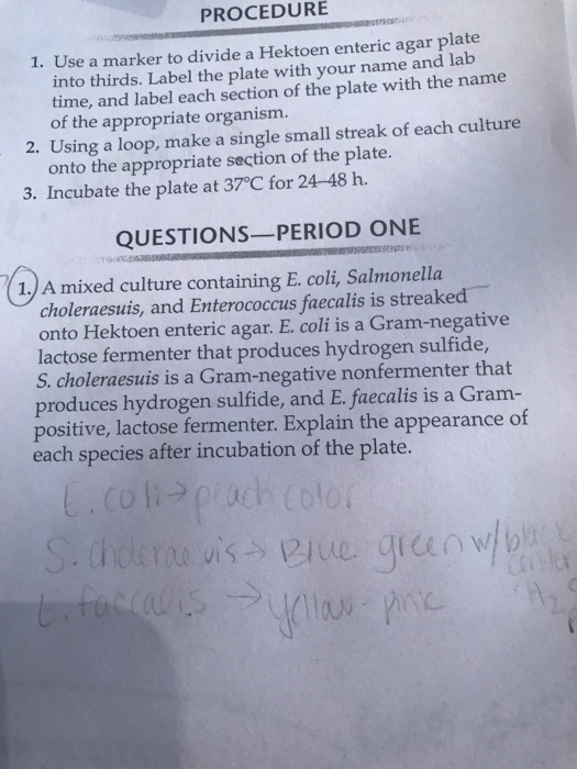 Where Should A Label Be Written On An Agar Plate Ythoreccio