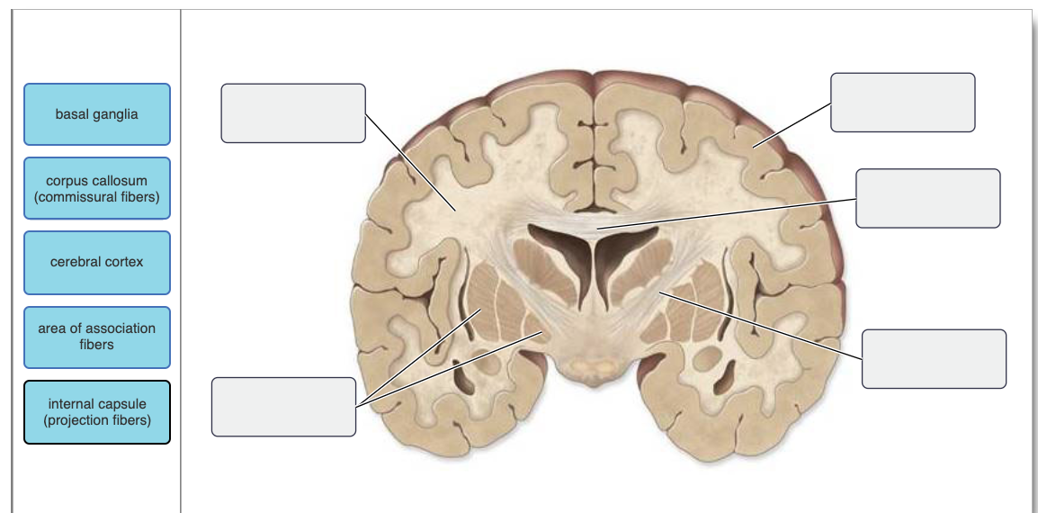 Solved Label the gray and white matter areas seen in this | Chegg.com
