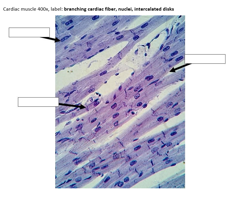 skeletal muscle under microscope labeled