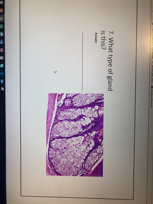 Solved 7. What type of gland is this?