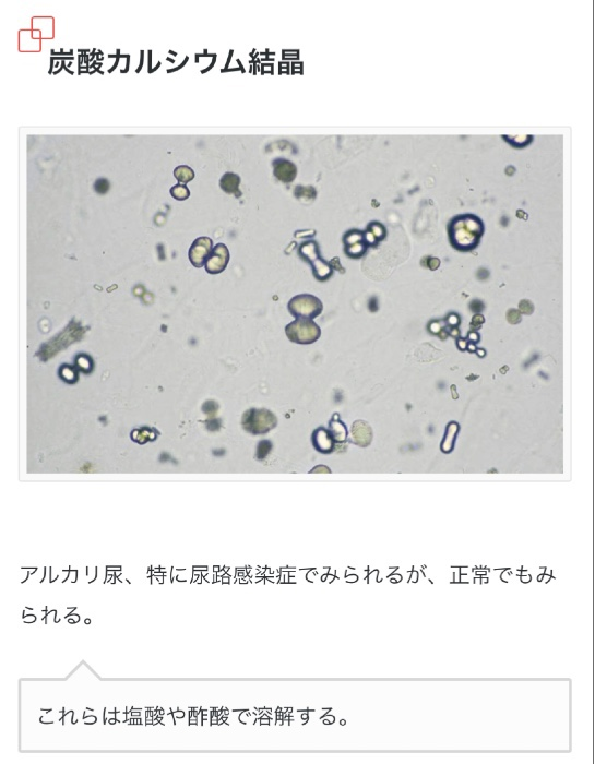 国試 検査総論 尿沈渣 Flashcards Chegg Com