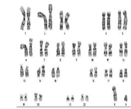 Solved identify the chromosomal abnormalities in this | Chegg.com