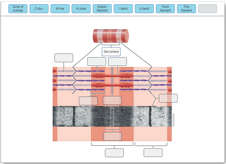Solved Zone of overlap Zdisc M line H zone Elastic filament