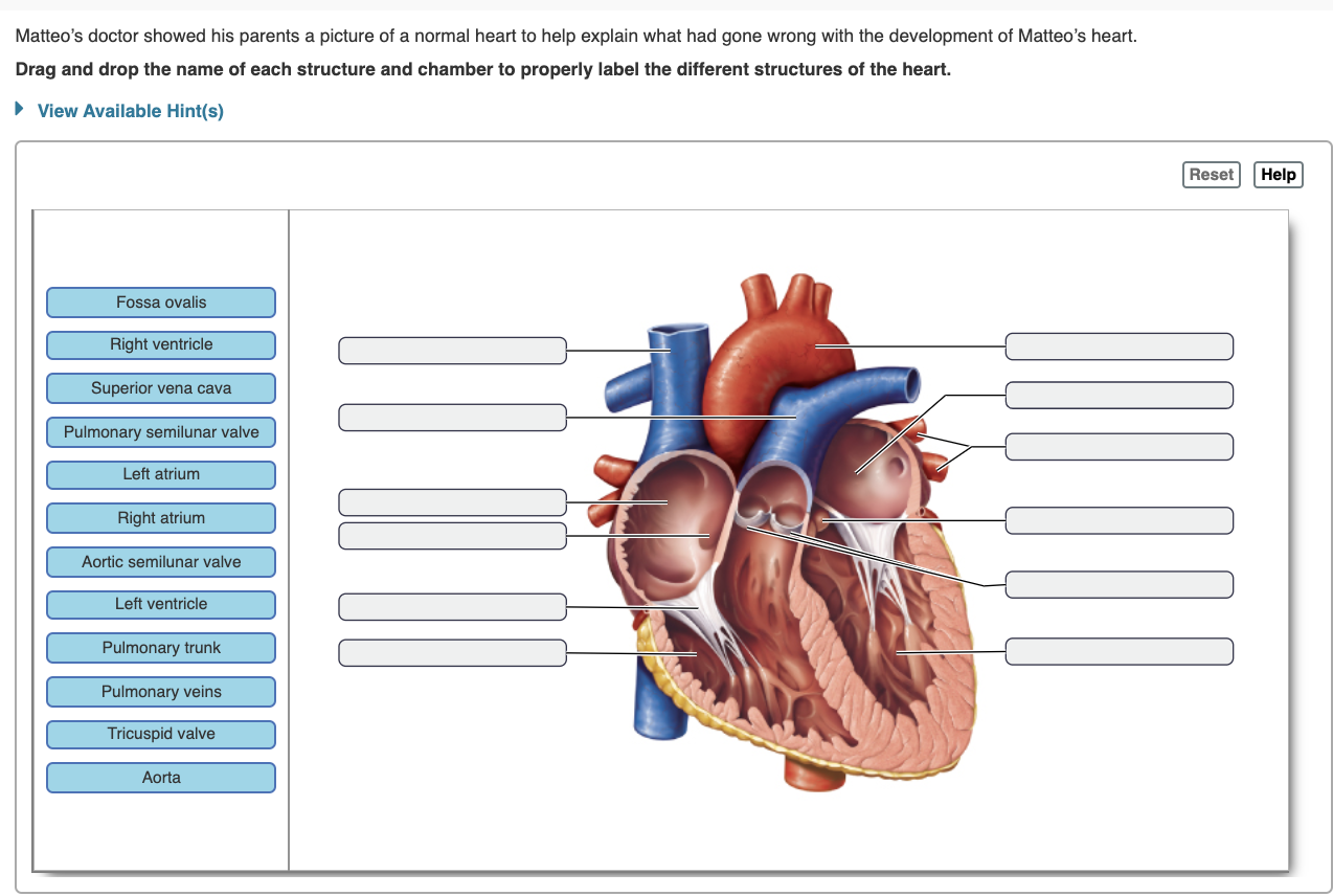 Solved Matteo's doctor showed his parents a picture of a | Chegg.com