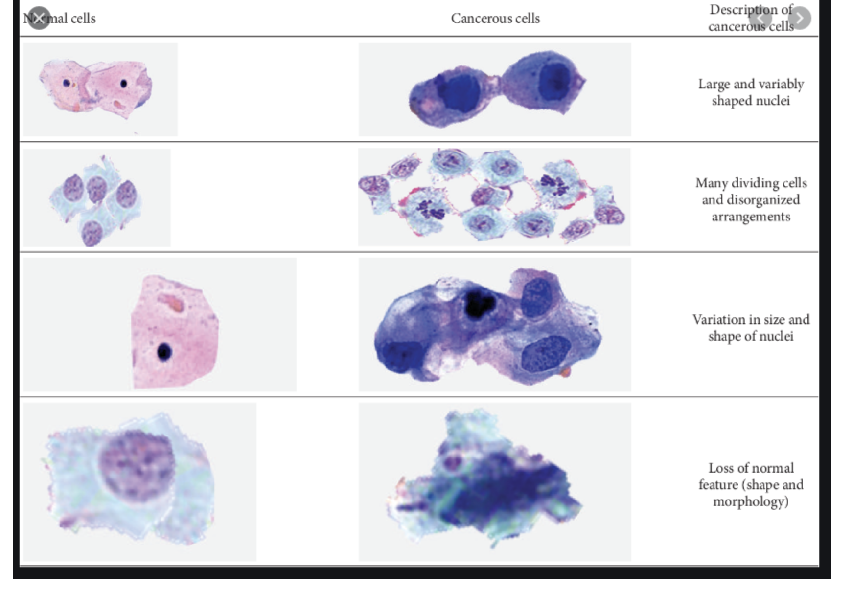 Solved NORMAL CELLS CANCEROUS CELLS Many cells that continue | Chegg.com