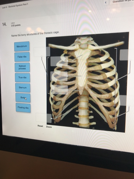 Solved Lab 6 Skeletal System Part 14. 212 points Name the | Chegg.com