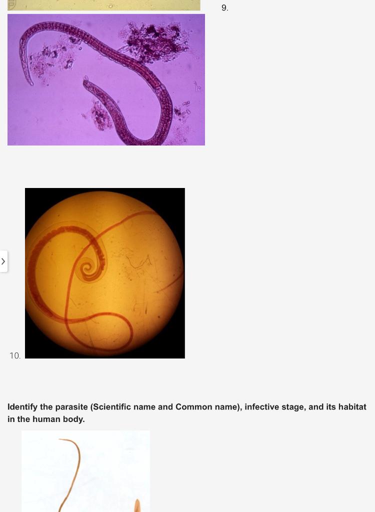 Instructions Identify the parasite (Scientific name | Chegg.com