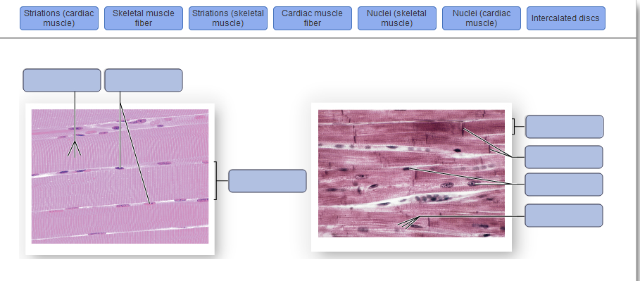 skeletal muscle fiber labeled