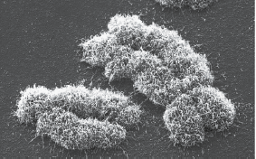 electron microscope images of chromosomes