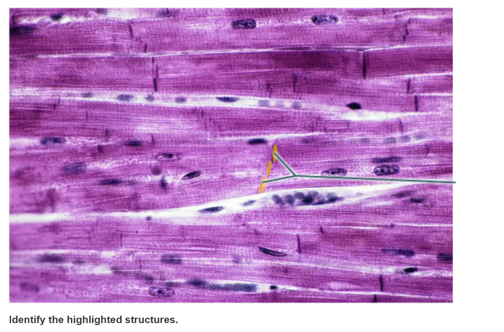 Solved Which structures are highlighted? O nuclei