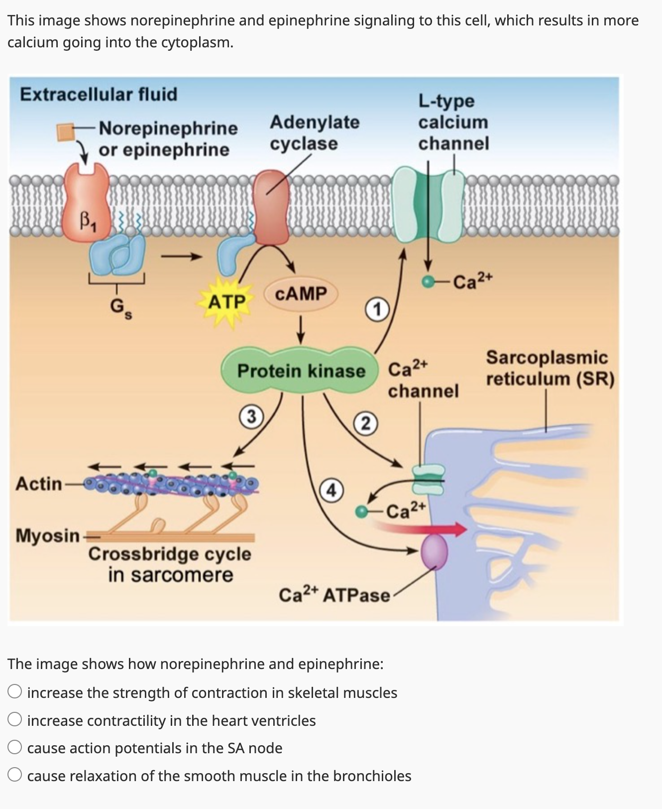 Solved This image shows norepinephrine and epinephrine | Chegg.com