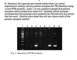 Solved B. Examine The Agarose Gel Results Below From An | Chegg.com