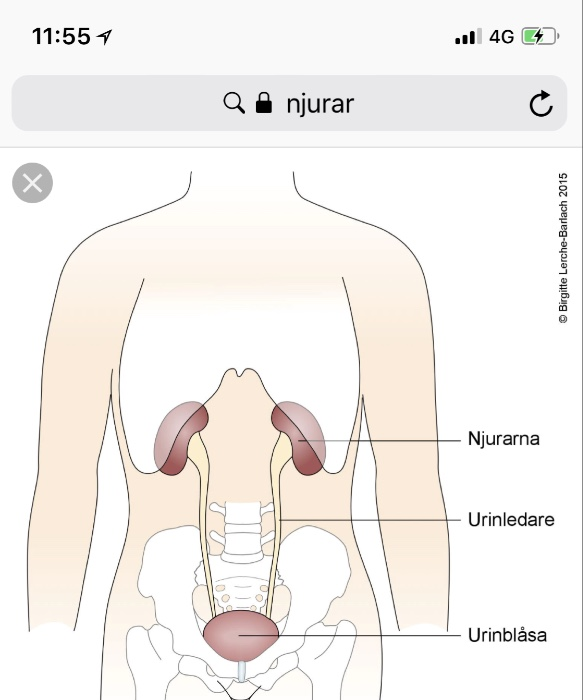 Njure Flashcards 