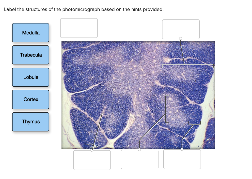 Solved Label The Structures Of The Photomicrograph Based On | Chegg.com