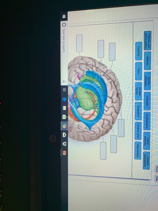 Solved Art-Labeling Activity: Brain anatomy O Type here to | Chegg.com