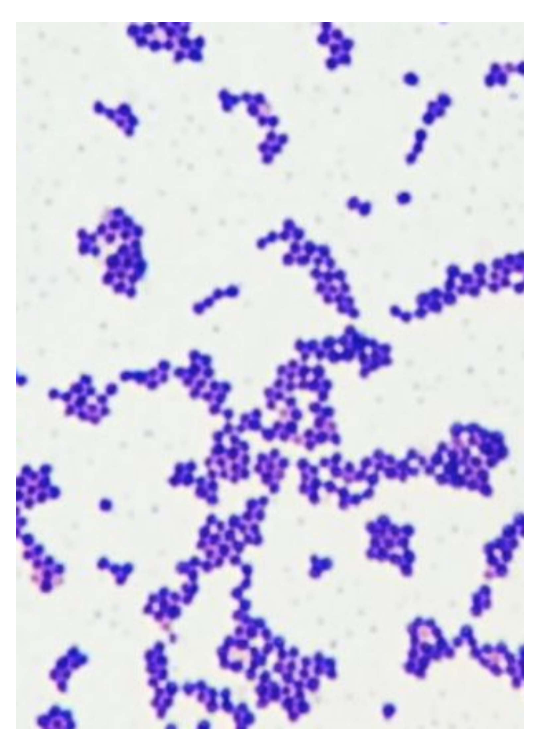 Solved Catalase Mannitol plate Coagulase (Staphyloslide | Chegg.com