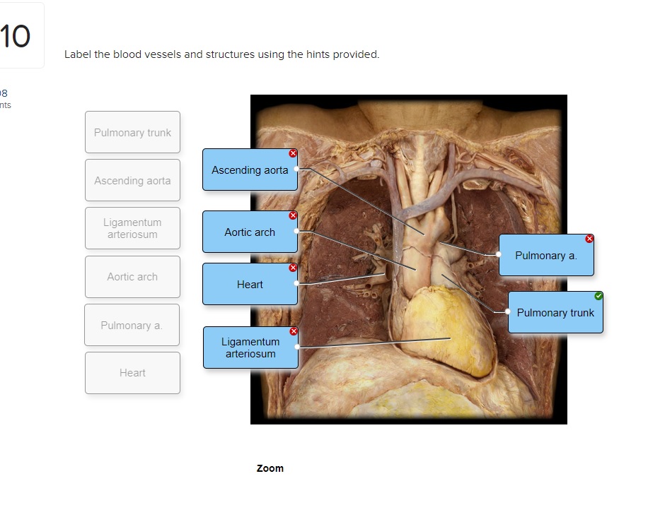 Solved Label the blood vessels and structures using the