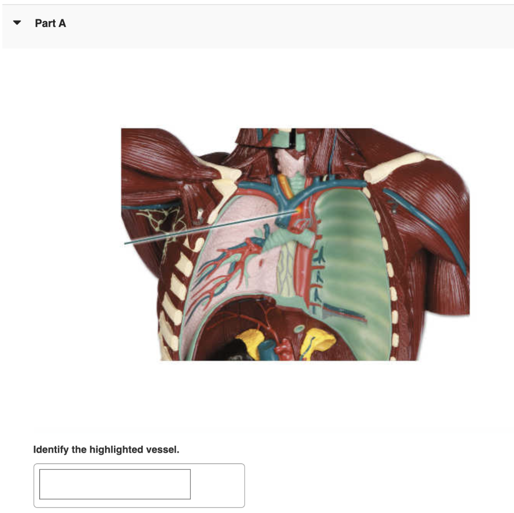 Part A
Identify the highlighted vessel.