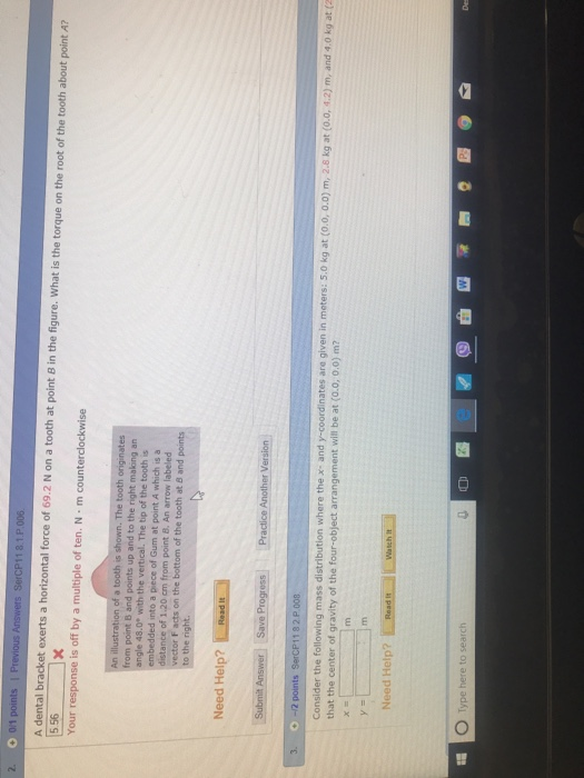 Solved 2. O 0/1 points A dental bracket exerts a horizontal