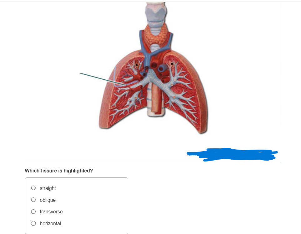 Which fissure is highlighted?
straight
oblique
transverse
horizontal