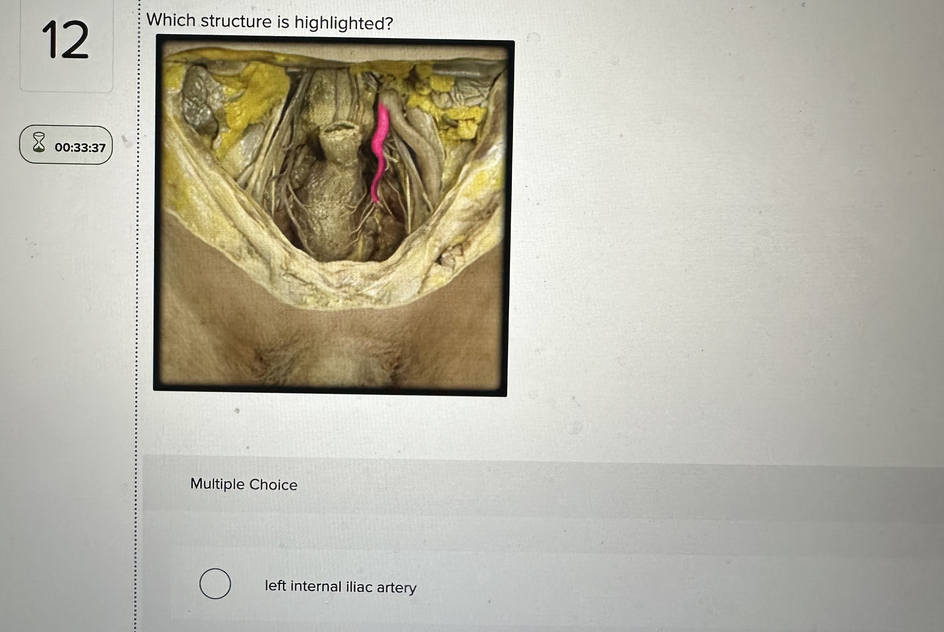 Solved Which structure is highlighted? Multiple Choice left