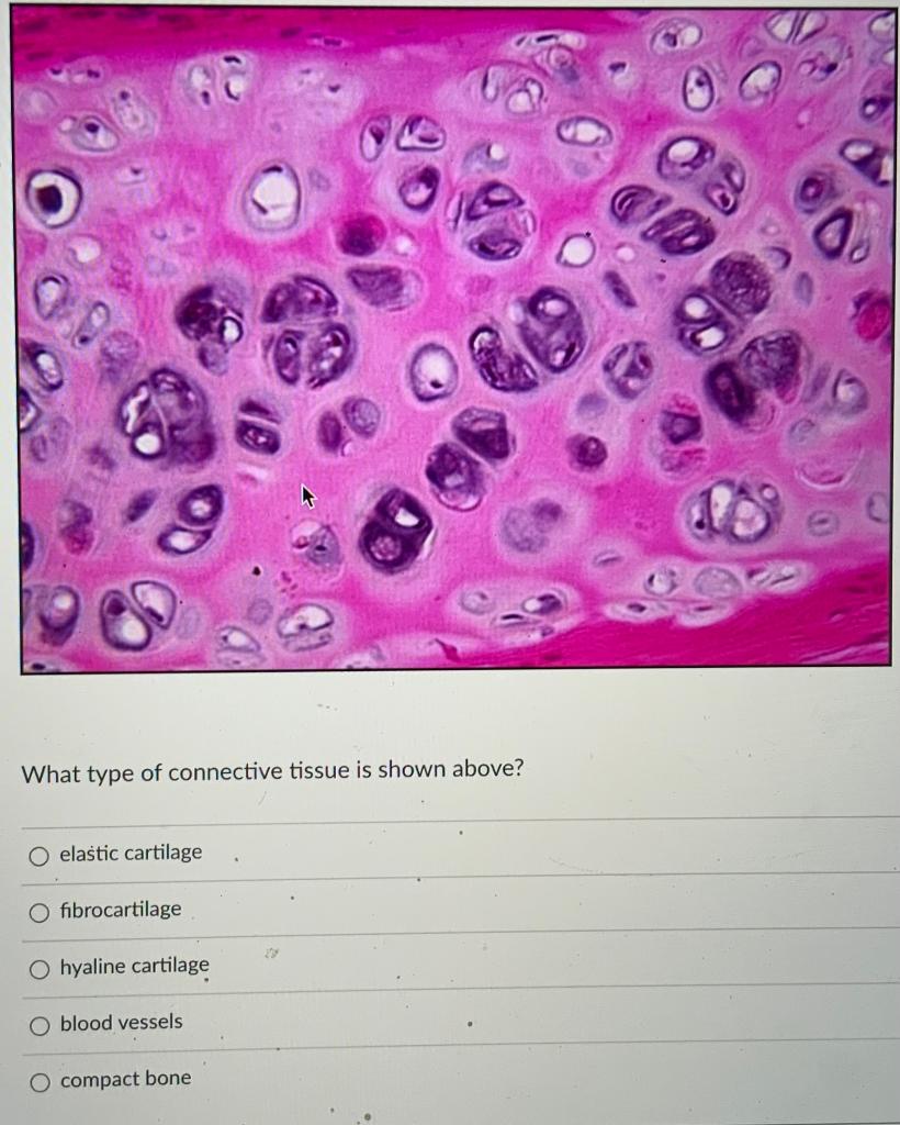 Solved What type of connective tissue is shown above? O | Chegg.com