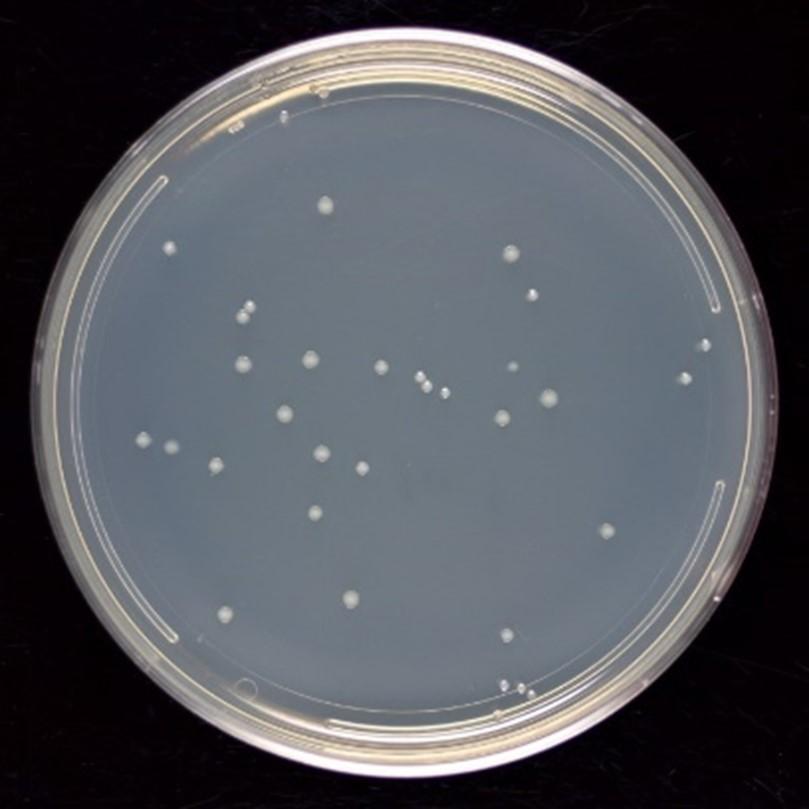 Solved 1) The bacteria culture plate shown was prepared