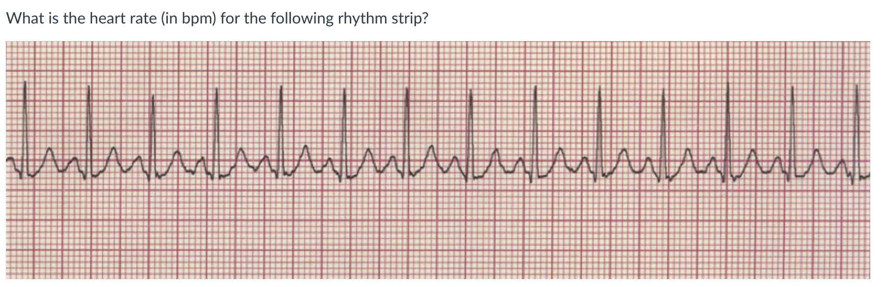 Solved What Is The Heart Rate Chegg Com   Screenshot2023 11 04at11.54.43AM 