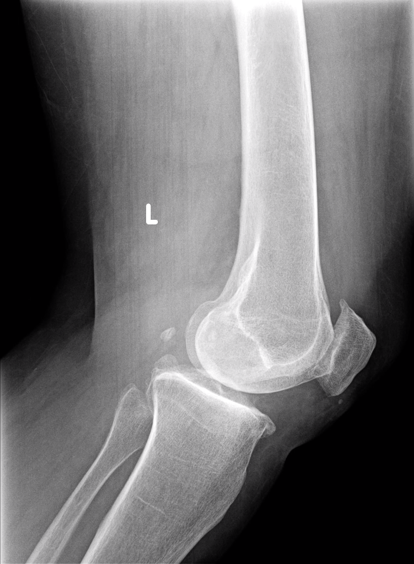9.34 AM Thu Apr 6 Radiology Report PATIENT INITIALS: | Chegg.com