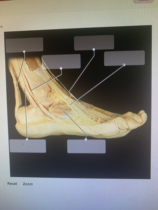 Solved Reset Zoom Label The Structures Of The Ankle 9 