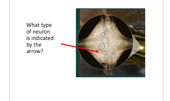 Solved What type of neuron is indicated by the arrow? | Chegg.com