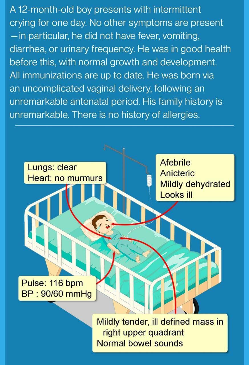 solved-a-12-month-old-boy-presents-with-intermittent-crying-chegg