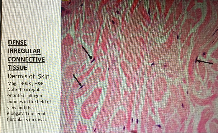 Dense Irregular Connective Tissue 400x