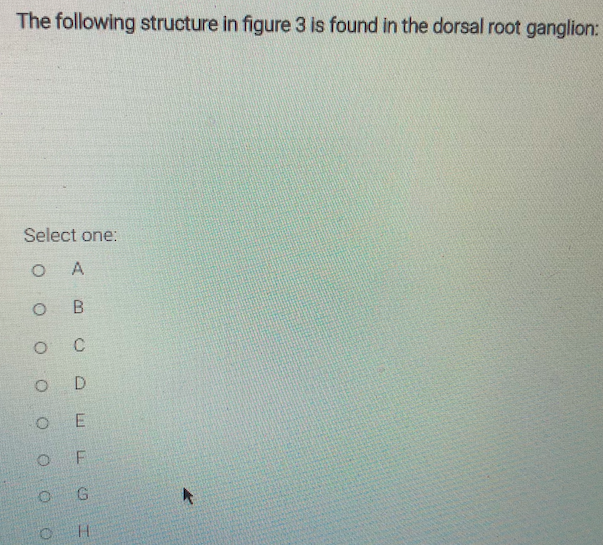 Solved Left Right F- H The following structure in figure 3 | Chegg.com