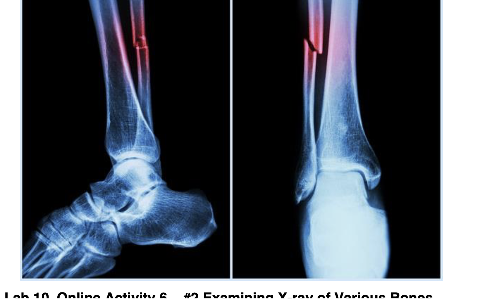 [Solved] Use the proper bone terminology to identify the v