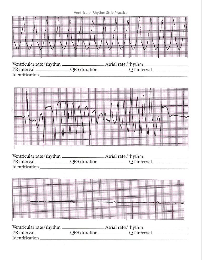 Solved Ventricular Rhythm Strip Practice Ventricular | Chegg.com